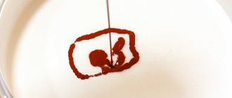 Preparation of enamel