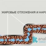 Grease on the walls of sewer pipes